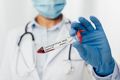 Corona Schnelltest bei Zuhause-pflegen SARS-Covid-19, SARS-CoV-2, Coronatest, Schnelltest Corona, Corona Schnelltest, Corona